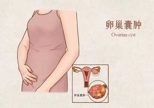 试管婴儿四个月胎位低怎么办,试管胎盘低要怎么做