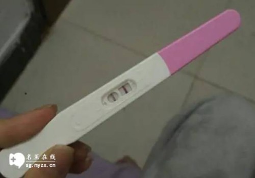 精索静脉曲张会带来这些影响，严重还会导致不孕不育