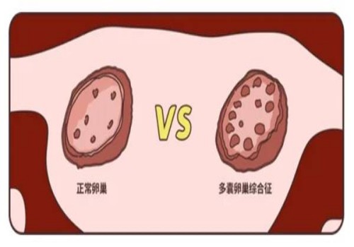 重庆助孕中心：新生儿黄疸严重or不严重？主要看新生儿黄疸的数值是多少