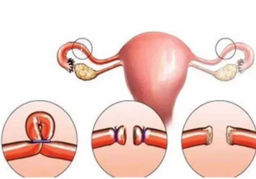 重庆正规助孕机构：新生儿脑积水的症状及治疗方法，宝宝脑积水一定要重视