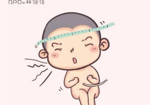 子宫下垂表现分三种，应对方法一定要get