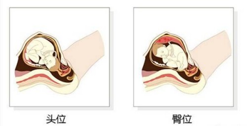 如何知道自己输卵管通不通？判断输卵管通不通的具体方法介绍