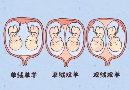 重庆助孕：多囊卵巢可以做试管婴儿吗,多囊卵巢做试管婴儿成功率高吗