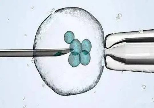 重庆试管婴儿价格：月经恶心想吐怎么回事，经期恶心想吐的常见原因须知