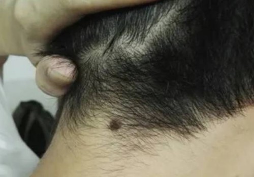 重庆三代试管助孕中心：产后康复要牢牢抓紧这一个月，恢复好让你如同新生